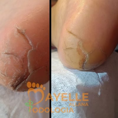 podologia em nova odessa podologia em nova odessa