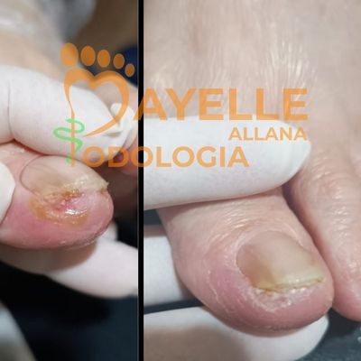 podólogo em nova odessa podólogo em nova odessa
