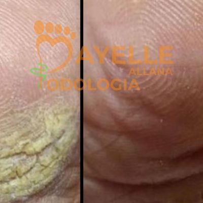 podólogo em sumaré podólogo em sumaré