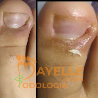 podopediatria em Sumaré podopediatria em Sumaré